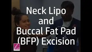 Six-Point Facial Contouring--Double Chin Lipo and Buccal Fat Pad Excision