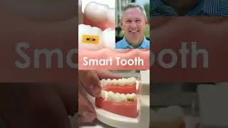 Smart Tooth 🦷  #diy #health #science #dental #teeth