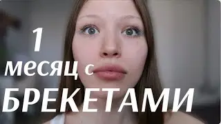 МЕСЯЦ С БРЕКЕТАМИ/ главные изменения, что я поняла?