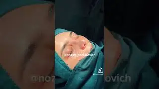 Нозим Шокирович. Ринопластика носа. Душанбе Таджикистан.