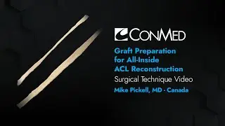 Graft Prep for All Inside ACL Reconstruction - Mike Pickell, MD - Surgical Technique