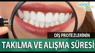 Diş Protezlerinin Takılma ve Alışma Süresi