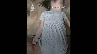 دون قطرة دم.. استشهاد طفلة فلسطينية خوفًا ورعبًا من صوت القصف الذي استهدف منزلهم