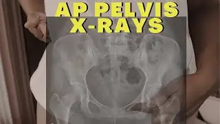 AP Pelvis X-ray Positioning & Centering Tips w/ Demo || Ask The Rad Tech