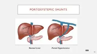 Portosystemic Shunts in 3 minutes.