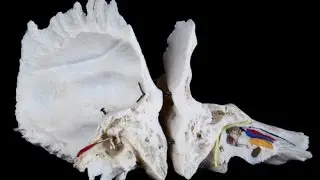 Temporal bone canals. Lecture on anatomy.