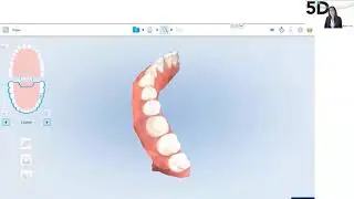 WEBINAR - iTero Digital restorative workflows at Shaw Lab Group