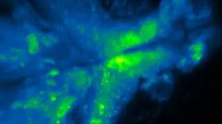 Whole-brain imaging of larval zebrafish