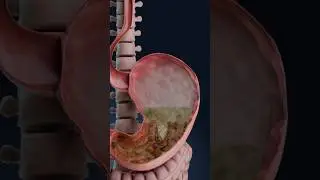 Bloating 3D visualization: what’s happening in your body?