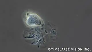 Dendritic cell -樹状細胞-