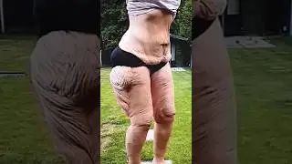FAÇA ISSO TODOS OS DIAS E ELIMINE A CELULITE / FLACIDEZ #celulites