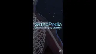 OrthoPedia - Dr. Denard Tips and Pearls Rotator Cuff Tears