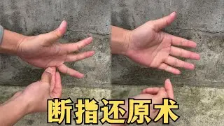My broken finger healed instantly, and today I finally cracked it #reveal #magic #funny