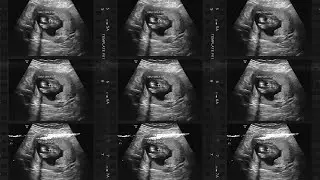 ESTOU GRÁVIDA!🤰🏼Parte 5: Descobrindo o GÊNERO e indo embora do BR🇧🇷
