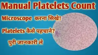 Manual Platelets count formula | Platelets count under microscope | Low Platelets | High Platelets