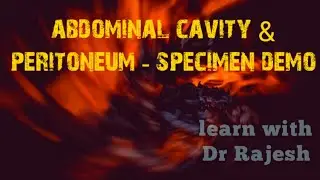 Abdominal Cavity & peritoneum
