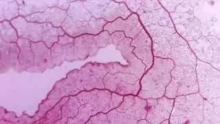 Physarum roseum