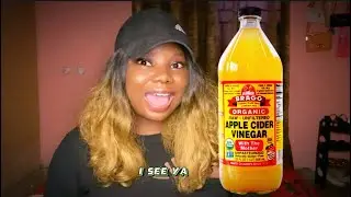 5 Reasons why you should start taking Apple Cider Vinegar ASAP!!