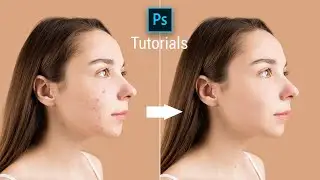 How to remove Blemishes in photoshop | Quick tutorial