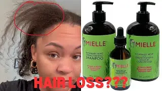IS MIELLE CAUSING HAIR LOSS???
