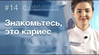 Главное о кариесе. Что это? Как лечат? Стадии кариеса.