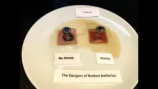 How a spoonful of honey could save your child's life