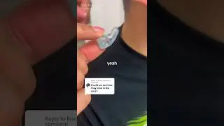 The “after” version of his ear impression for music plugs