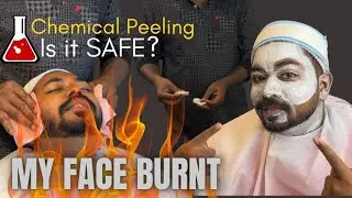 கெமிக்கல் பீலிங் ஃபேஷியல் பாதுகாப்பானதா? How Chemical Peeling Facial Done? | Tamil | ஃபயர் ஃபேஷியல்.