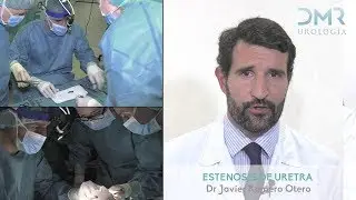 ESTENOSIS DE URETRA Dr. Romero