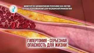 Гипертония серьезная опасность для жизни
