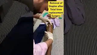 Removal of staples generally after 10-14 days of total knee replacement surgery #woundhealing #knee
