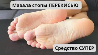 ПЯТКИ КАК У МЛАДЕНЦА БЕЗ НАТОПТЫШЕЙ , МОЗОЛЕЙ И ТРЕЩИН  / Всего лишь ПЕРЕКИСЬ..
