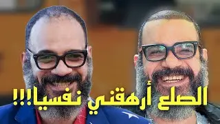 ندمت أني ما زرعت قبل! تجربتي مع زراعة الشعر بعد 10 أيام