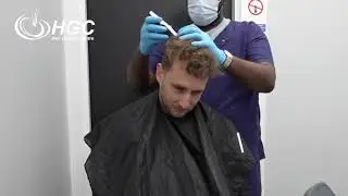 👨‍⚕️ A Day in the Life of a Hair Transplant  Dr Alosert at Hair Growth Centre