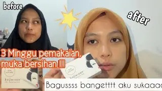 3 Minggu pake Kojie San, muka jadi bersihan