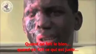 BOULEVERSANT Défiguré, il pardonne et loue Dieu ! Témoignage chrétien d'Umar Mulinde