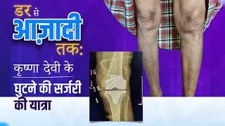 From Fear to Freedom: Krishna Aunty’s Knee Surgery Journey!
