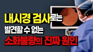소화가 안 될 때 단순히 소화불량이라고 생각하면 큰일납니다. 내시경 검사로는 찾을 수 없는 위장장애의 진짜 이유  ㅣ 노기환 병원장