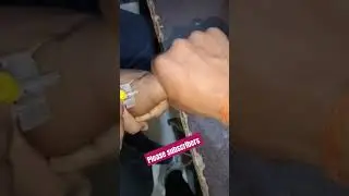 cannulation.. video.. part 503 