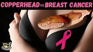 Breast Cancer Breakthrough: Copperhead Venom
