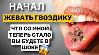 Просто начала ЖЕВАТЬ гвоздику 1 раз в день! Результат удивил!  Польза и вред гвоздики