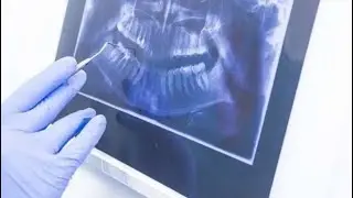 INI HARGA rontgen foto panoramic gigi❗️TAPI bisa GRATIS kalau . . . . Simak videonya sampai habis