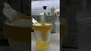 пробирка для мочи 
