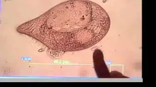 Rife-Bare Plasma Experiment Destroys Microorganisms (June 28 '07)