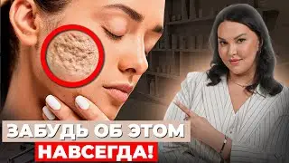 РУБЦЫ УЙДУТ! Как избавиться от постакне НАВСЕГДА?