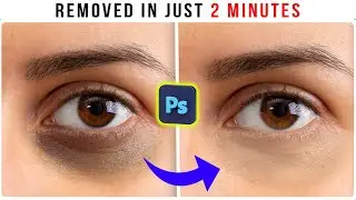 how to remove dark circle or pimple in photoshop | Remove deep dark circles in photoshop