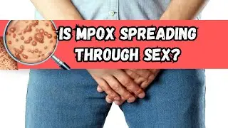 Is Mpox (Monkeypox) A Sexually Transmitted Disease?