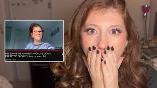 REACT: NO ONE LIKES ME BECAUSE OF MY FACIAL PARALYSIS