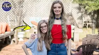 UNUSUAL TWINS YOU WON'T BELIEVE EXIST #2