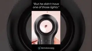 Do You Use "One of Those Lights"?